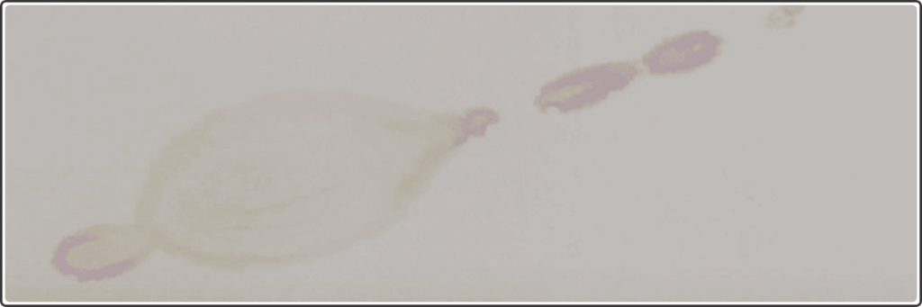 damp patches on ceiling caused by terrace leakage and seepage